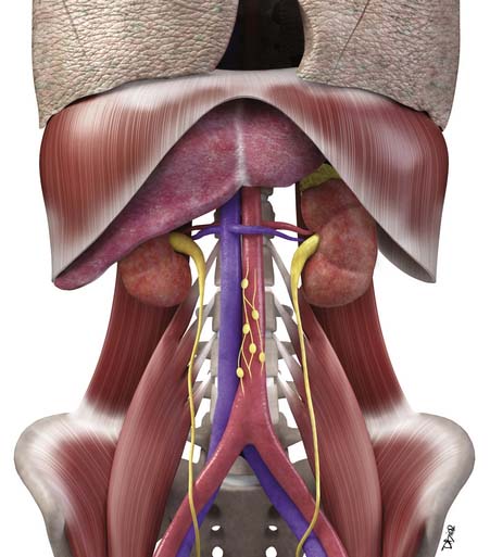 Medical publication visual for An Atypical Presentation of a Retroperitoneal Tumor: A Case Report