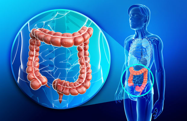 Medical illustration for Colon & Rectal Cancer