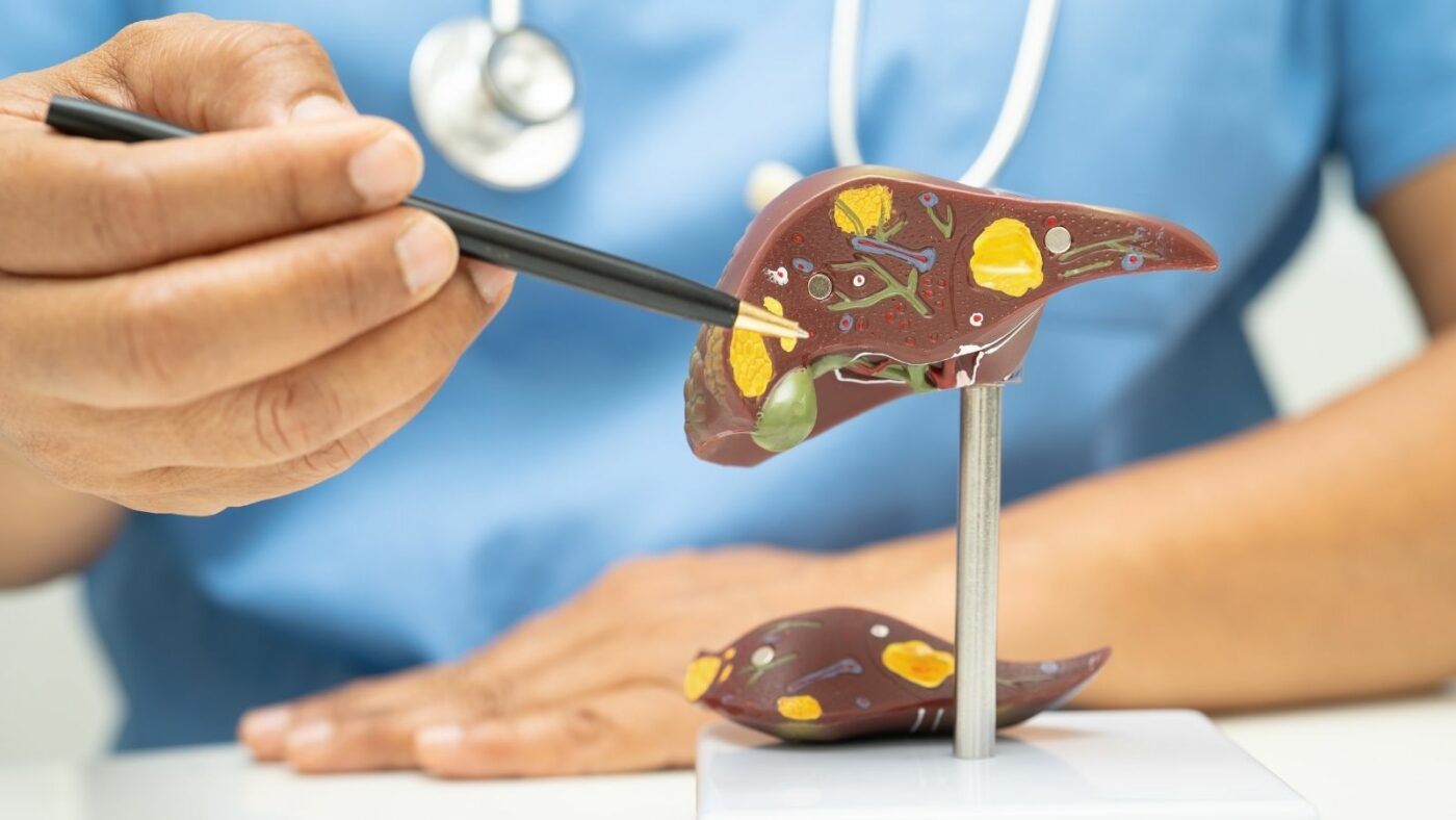Medical illustration for Liver Tumors & Liver Cancer